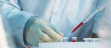 Pipette Calibration Services Market