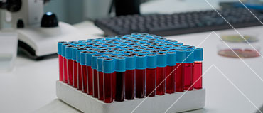 Hematology Analyzers and Reagents Market