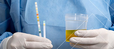 Urinalysis Market