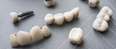 Dental Bone Graft Substitute Market Size And Global Industry Forecast 2029