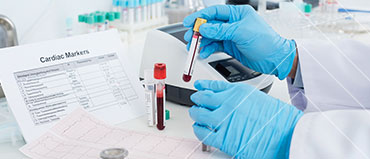 Cardiac Marker Testing Market
