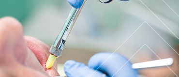 Dental Sutures Market