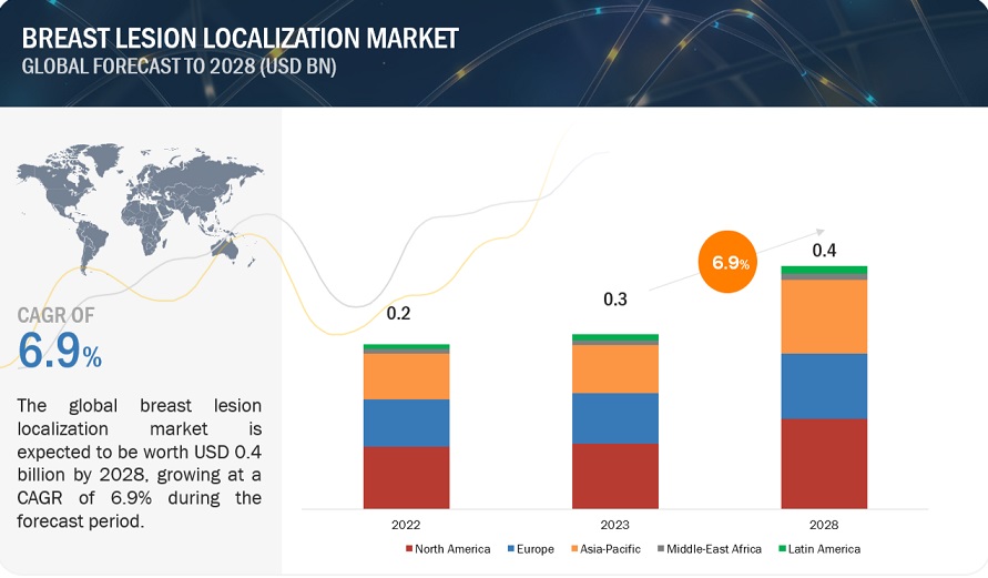 Breast Lesion Localization Methods Market